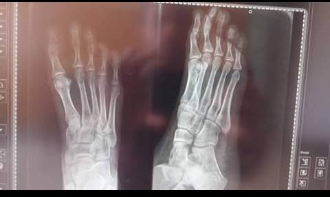 أغرب صورة أشعة فى مستشفى الطلبة فى الأسكندرية