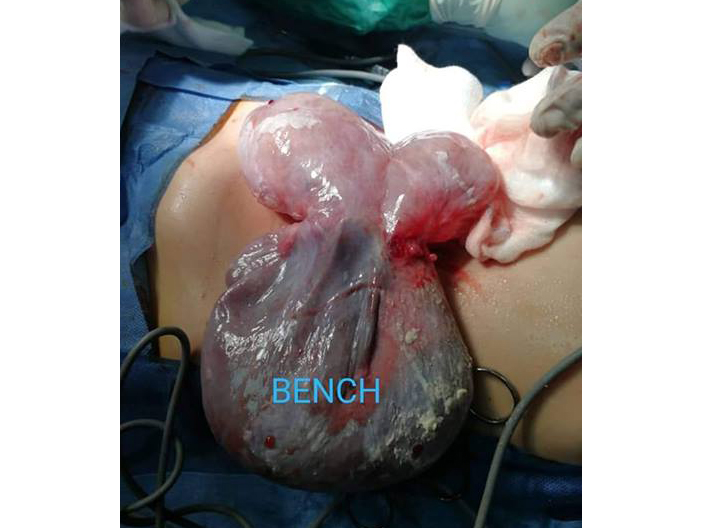 اطباء مستشفي اطفال بنها التخصصي ينقذون حياة طفلة